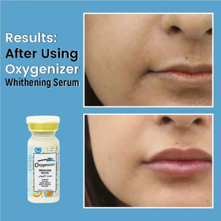 OXYGENIZER SERUM